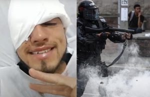 Joven facatativeño pierde ojo por presunto disparo del ESMAD