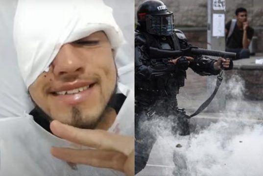 Joven facatativeño pierde ojo por presunto disparo del ESMAD