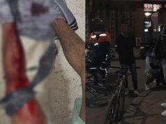 Riñas con armas cortopunzantes en Praderas de Mosquera