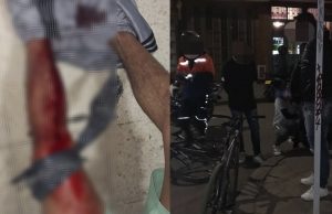 Riñas con armas cortopunzantes en Praderas de Mosquera