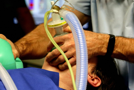 Imprudencia de motociclista causa fatal accidente