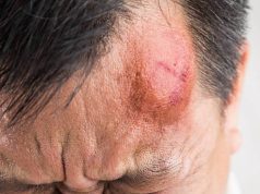 Aumenta la inseguridad en Mosquera: hombre fue golpeado con un arma de fuego