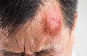 Aumenta la inseguridad en Mosquera: hombre fue golpeado con un arma de fuego