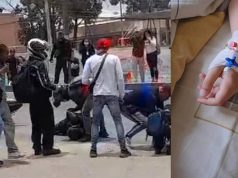 Fuerte accidente: motociclista arrolló a un menor en Cundinamarca motociclista arrolló a un menor de 12 años.