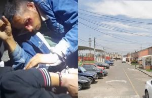Atención: atacan con machete a dos ladrones en Funza atacan con machete a dos ladrones