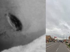 Atención: joven recibe varias puñaladas tras ser robado Joven recibe varias puñaladas