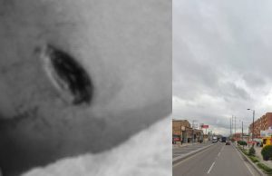 Atención: joven recibe varias puñaladas tras ser robado Joven recibe varias puñaladas