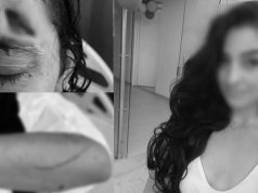 Con palos y botellas: un hombre atacó a una mujer