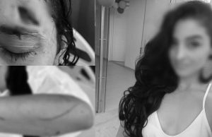 Con palos y botellas: un hombre atacó a una mujer