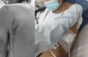 Recibió varias puñaladas por no dejarse robar en Funza puñaladas por no dejarse robar