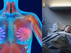 ¿El 30% de los casos de cáncer pueden curarse? Aquí le contamos El 30% de los casos de cáncer pueden curarse