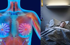 ¿El 30% de los casos de cáncer pueden curarse? Aquí le contamos El 30% de los casos de cáncer pueden curarse