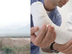 Funza: casi pierde una pierna por orinar en la calle por orinar en la calle