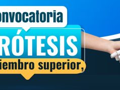 Cundinamarca ofrece prótesis gratuitas con tecnología 3D Cundinamarca ofrece prótesis gratuitas con tecnología 3D