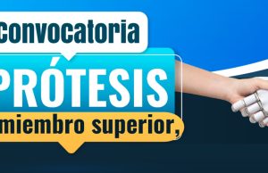 Cundinamarca ofrece prótesis gratuitas con tecnología 3D Cundinamarca ofrece prótesis gratuitas con tecnología 3D