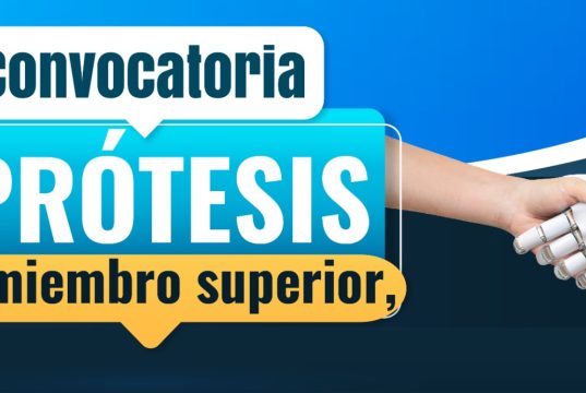 Cundinamarca ofrece prótesis gratuitas con tecnología 3D Cundinamarca ofrece prótesis gratuitas con tecnología 3D