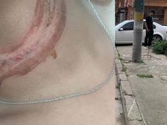 Ciudadana sufre grave accidente por cable suelto en Madrid