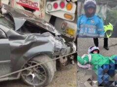Motociclista perdió una pierna en grave accidente