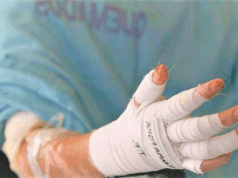 Navidad con cifras que alarman: niños siguen entre las víctimas de la pólvora en Cundinamarca