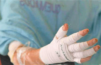 Navidad con cifras que alarman: niños siguen entre las víctimas de la pólvora en Cundinamarca