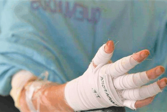 Navidad con cifras que alarman: niños siguen entre las víctimas de la pólvora en Cundinamarca