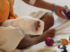 La pólvora vuelve a cobrar víctimas: grave caso en Mosquera