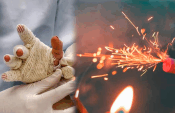 Cundinamarca en alerta por lesionados con pólvora