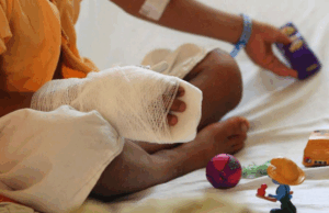 Aumento personas quemadas con pólvora enciende las alertas