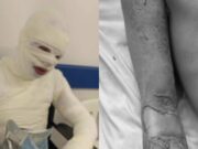 Recluso terminó gravemente quemado en Cundinamarca